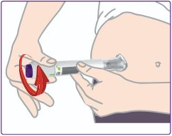 Placing the base on the skin and unlocking